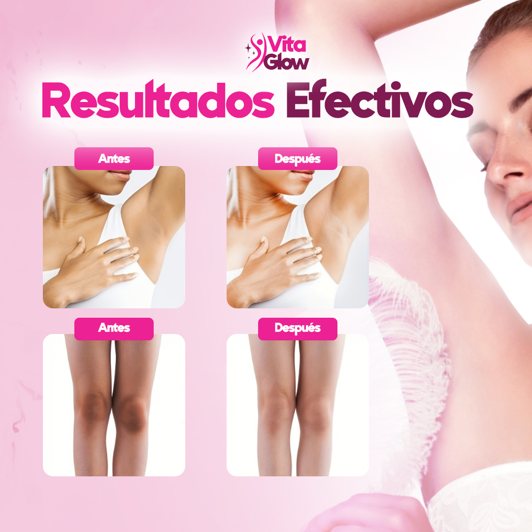 VitaGlow® Crema blanqueadora de zonas sensibles| 1+1 Gratis
