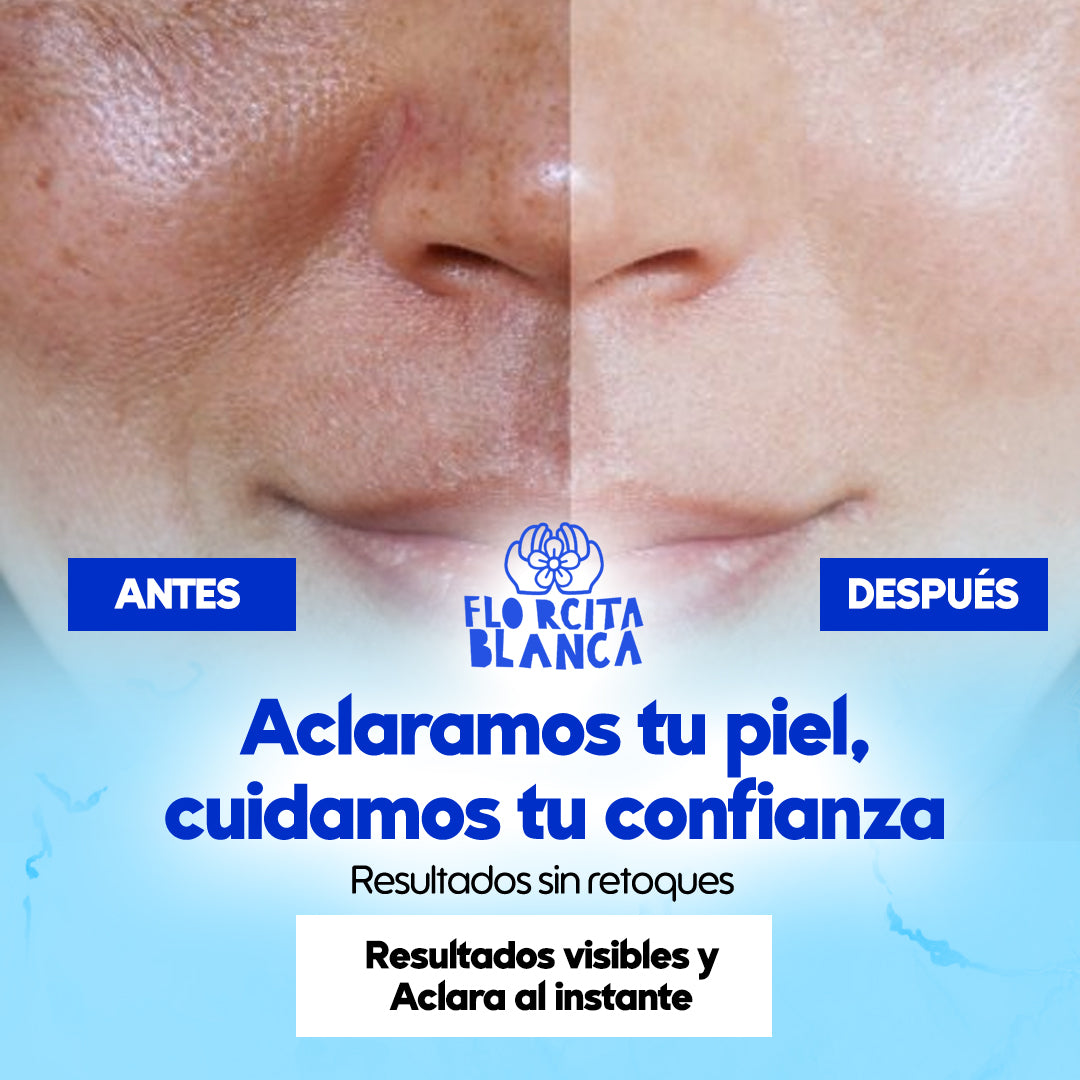 FlorcitaBlanca® Crema Blanqueadora ¡Recupera tu brillo natural 1 + 1 GRATIS