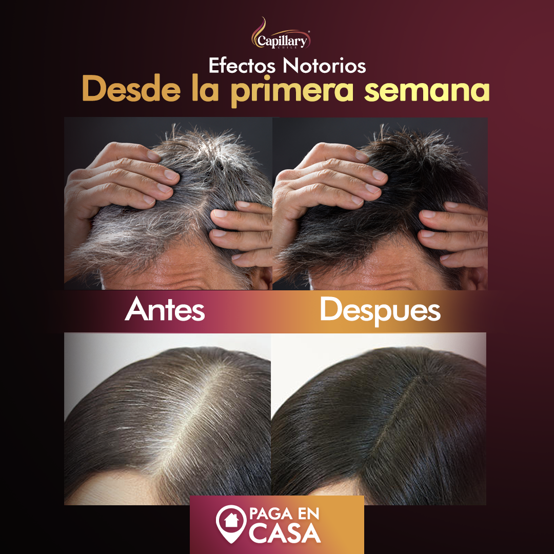 ¡1 + 1 GRATIS! Capillary® Shampoo en Barra Anti-Canas – ¡Recupera el Color Natural de tu Cabello DEFINITIVAMENTE!
