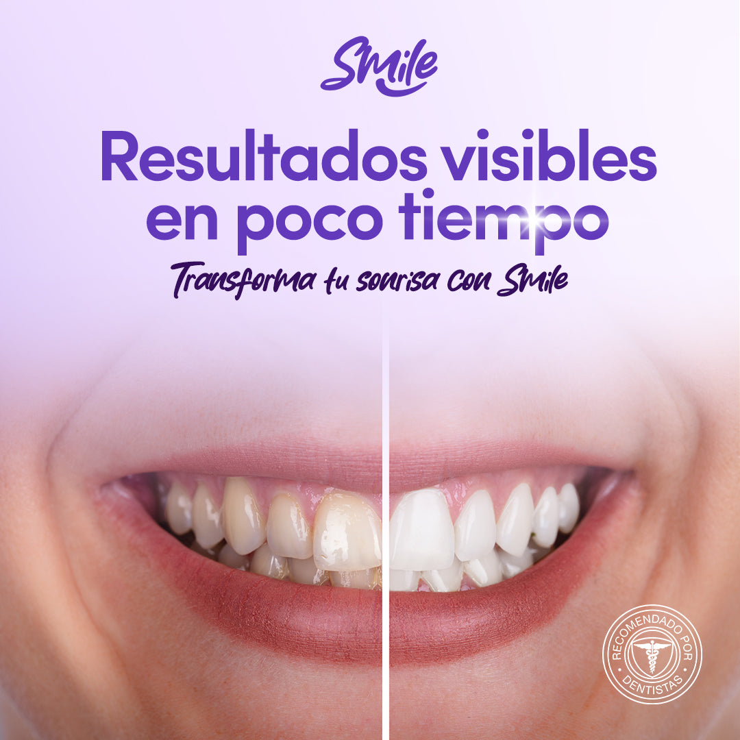 ¡1 + 1 GRATIS! Smile® - ¡La SOLUCIÓN para los dientes amarillos y el MAL OLOR! 50ML