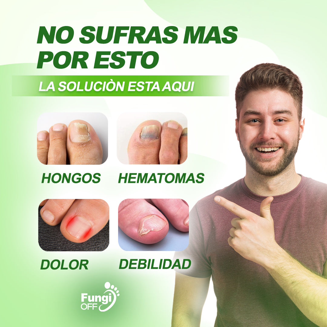¡1 + 1 GRATIS! Fungi Off® - ¡LAS GOTAS que ELIMINAN HONGOS, HEMATOMAS y DOLOR en tus PIES!