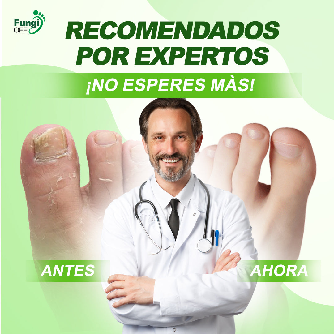 ¡1 + 1 GRATIS! Fungi Off® - ¡LAS GOTAS que ELIMINAN HONGOS, HEMATOMAS y DOLOR en tus PIES!