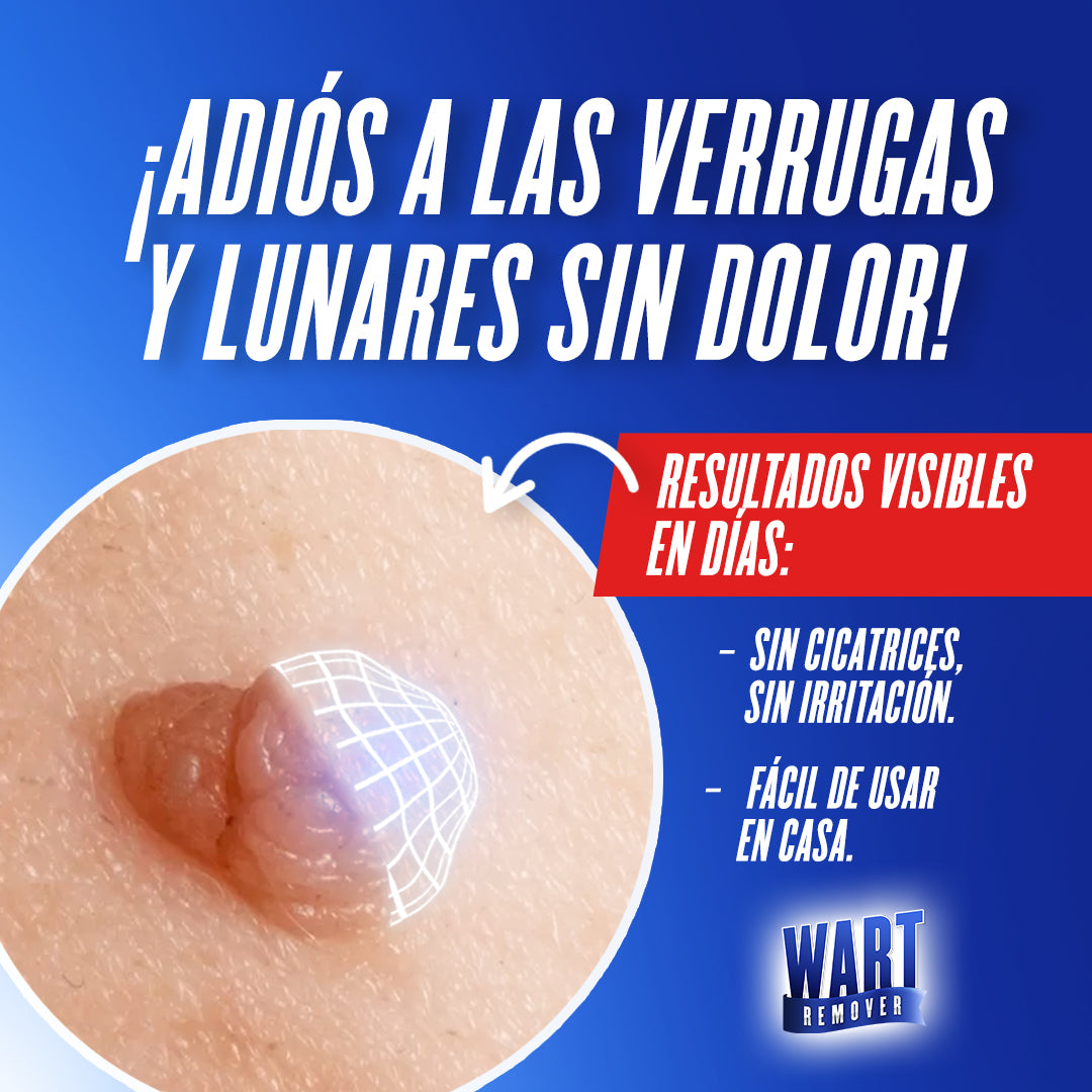 ¡1+ 1 GRATIS! Wart Remover® - ¡La SOLUCIÓN para ELIMINAR VERRUGAS y LUNARES sin DOLOR!