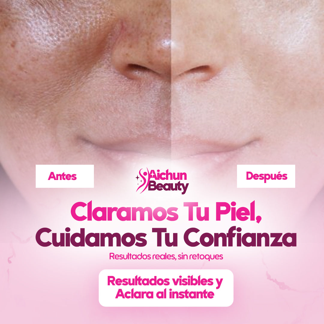 ¡1 + 1 GRATIS! Aichun Beauty® - ¡La CREMA BLANQUEADORA que tu PIEL SE MERECE!