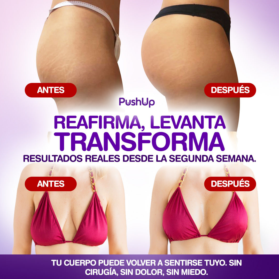PushUp® Pack Reafirmante Total - Senos & Glúteos Sin Cirugía | 1+1 GRATIS