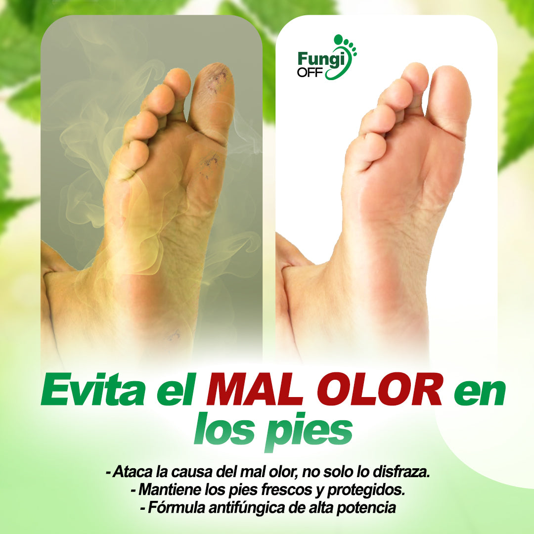 ¡1 + 1 GRATIS! Fungi Off® - ¡LAS GOTAS que ELIMINAN HONGOS, HEMATOMAS y DOLOR en tus PIES!