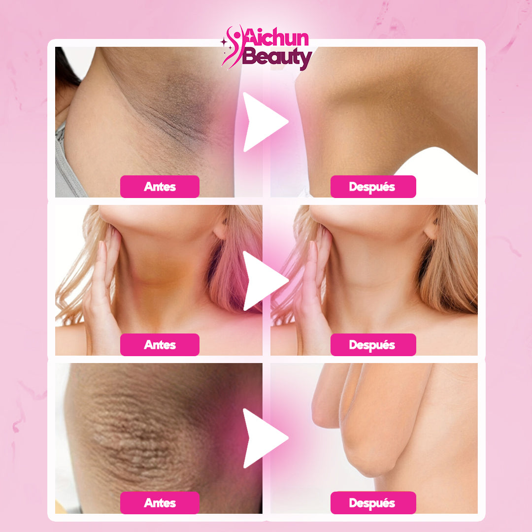 ¡1 + 1 GRATIS! Aichun Beauty® - ¡La CREMA BLANQUEADORA que tu PIEL SE MERECE!