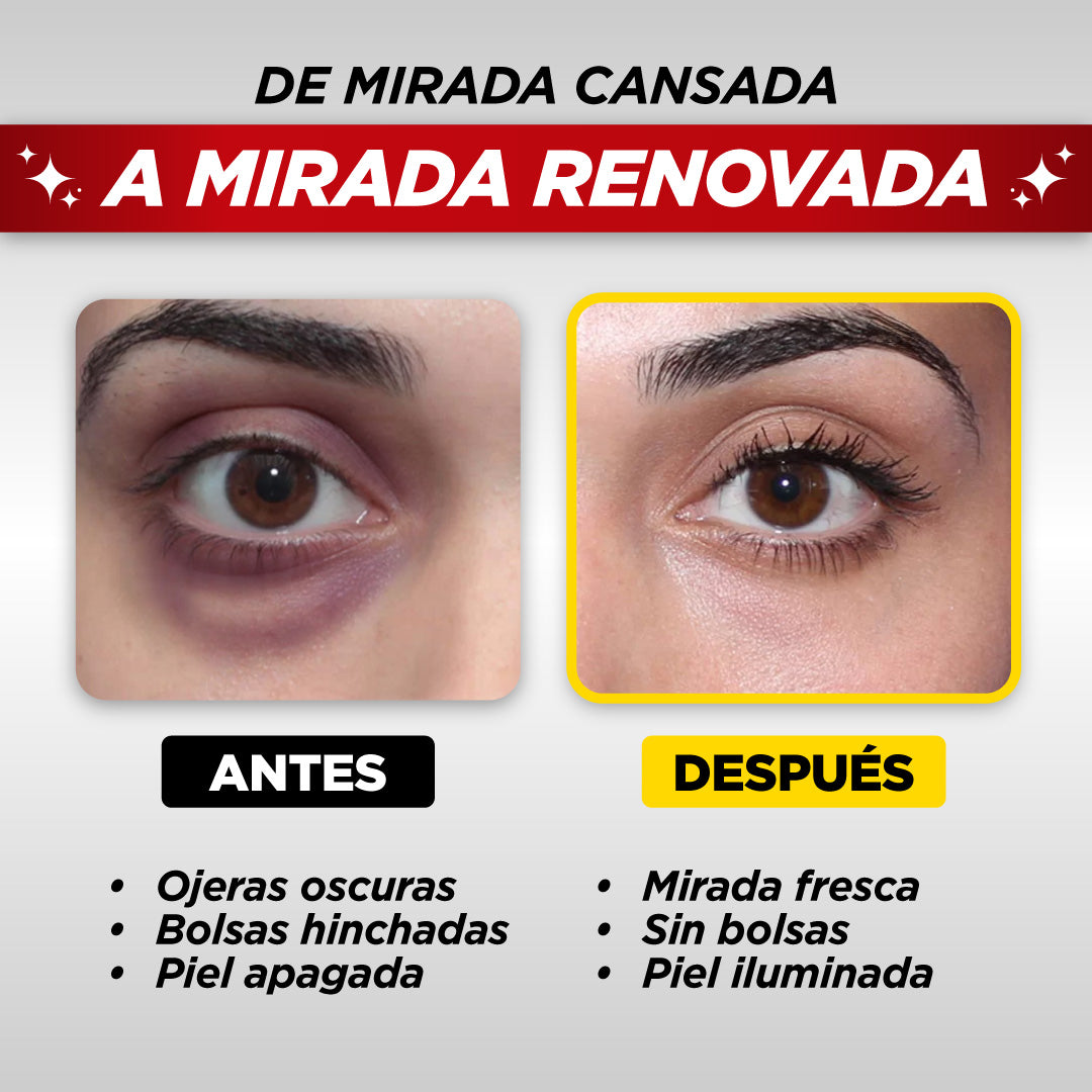 LiftEyes® – Contorno de Ojos Antiojeras Y Antifatiga | 1+1 GRATIS