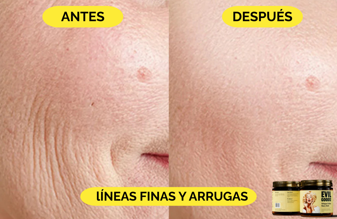 EvilGoods®-bálsamo rejuvenecedor con Sebo de Res Y Miel de Manuka |1+1 GRATIS