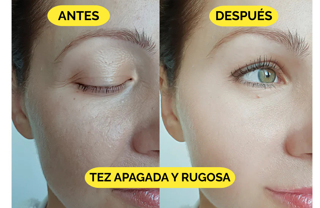 EvilGoods®-bálsamo rejuvenecedor con Sebo de Res Y Miel de Manuka |1+1 GRATIS