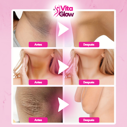 VitaGlow® Crema blanqueadora de zonas sensibles| 1+1 Gratis