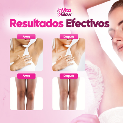VitaGlow® Crema blanqueadora de zonas sensibles| 1+1 Gratis