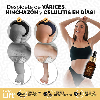 BodyLift® Serum - Reductor y reafirmante con acción drenante y anti-varices | 1+1 GRATIS