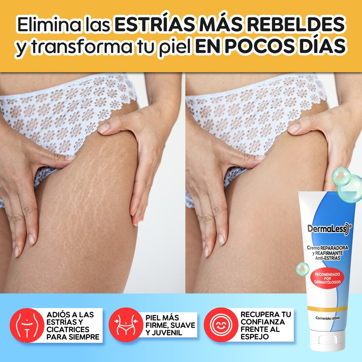 DermaLess® – Borrador Intensivo de Estrías y Reafirmante Total | 1+1 GRATIS