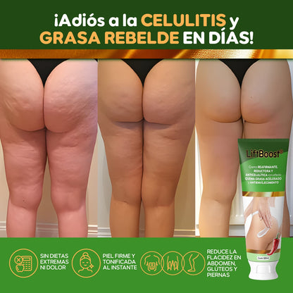 LiftBoost® – Crema Reafirmante & Quema Grasa Total | 1+1 GRATIS
