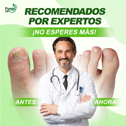 ¡1 + 1 GRATIS! Fungi Off® - ¡LAS GOTAS que ELIMINAN HONGOS, HEMATOMAS y DOLOR en tus PIES!