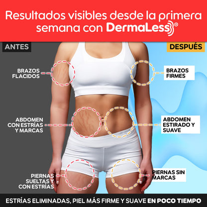 DermaLess® – Borrador Intensivo de Estrías y Reafirmante Total | 1+1 GRATIS