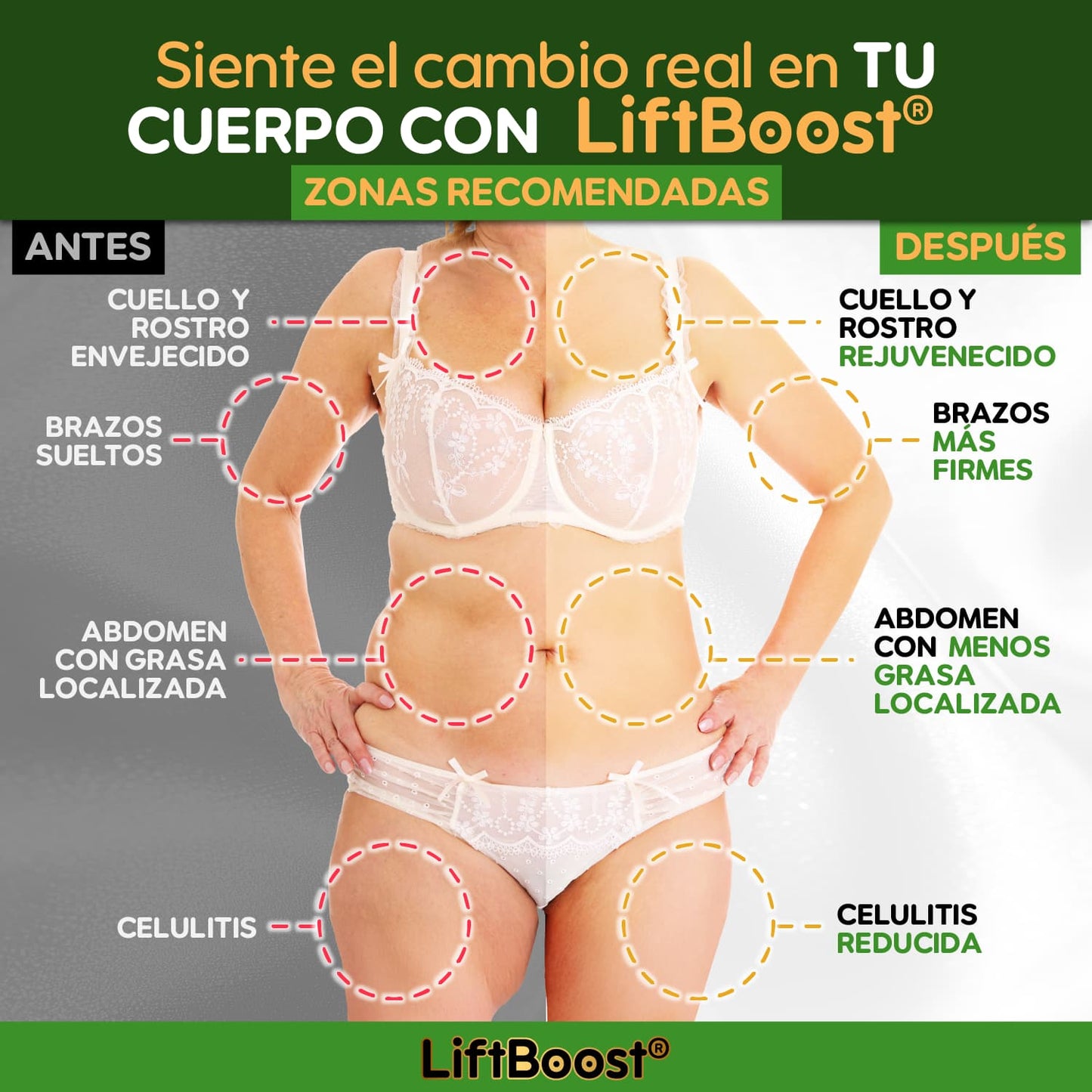 LiftBoost® – Crema Reafirmante & Quema Grasa Total | 1+1 GRATIS