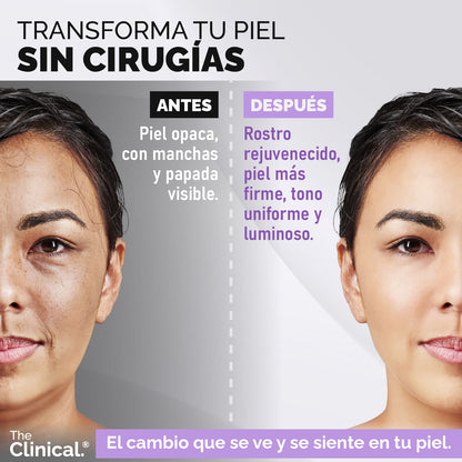 TheClinical® – Serum Rejuvenecedor & Anti-Manchas Total |1+1 Gratis