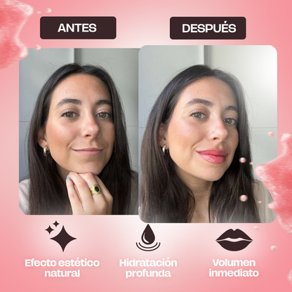 LipBoost® – Voluminizador Instantáneo de Labios| 1+1 Gratis
